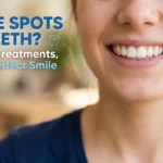 Close-up of a person smiling brightly to show visible white spots on front teeth, illustrating common enamel demineralization or fluorosis.